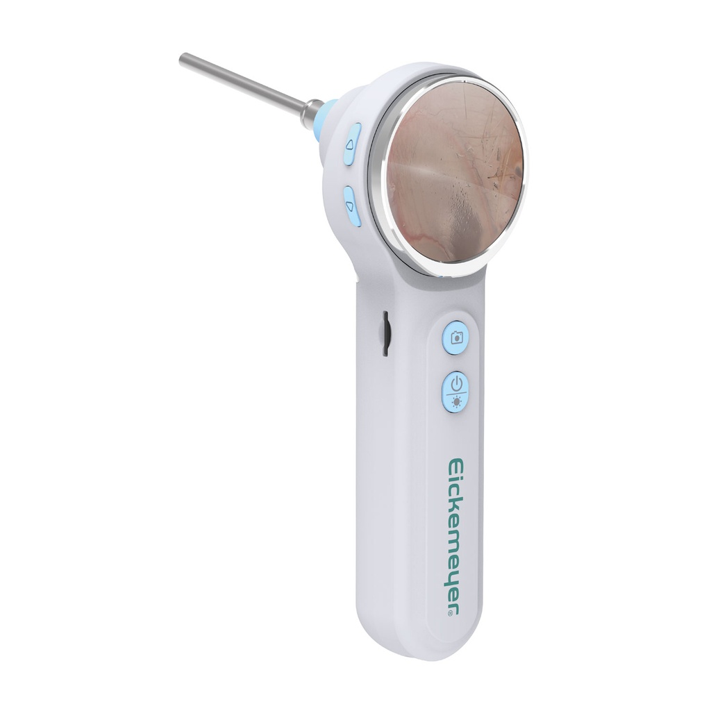 EickView OTO – cyfrowy wideotoskop