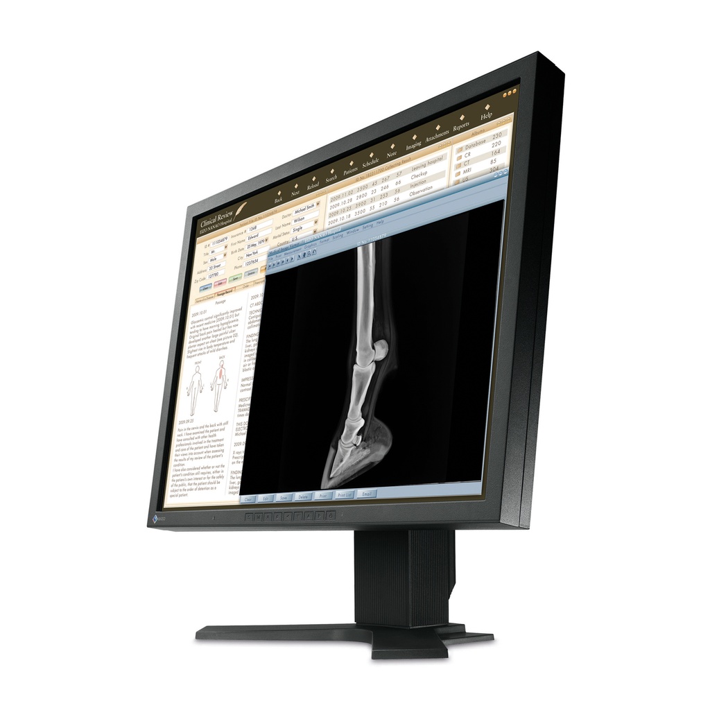 EIZO FlexScan 23,8" (60cm) LED EV2450-BK- Nadaje się do obserwacji zgodnie z QS-RL   Rozdz. 8.2 i DIN V 6868-57 Rozdz. 5.1